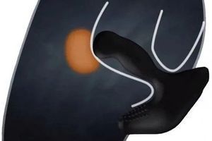 Masaż prostaty bez tajemnic – jak go wykonać dla maksymalnej przyjemności? zdjęcie